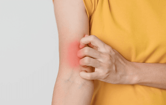 Hemorrhoid Treatment