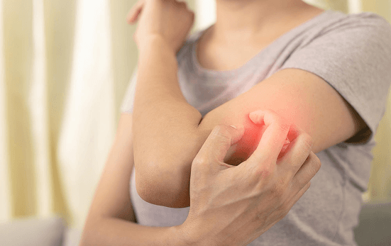 Bug Bites & Rashes